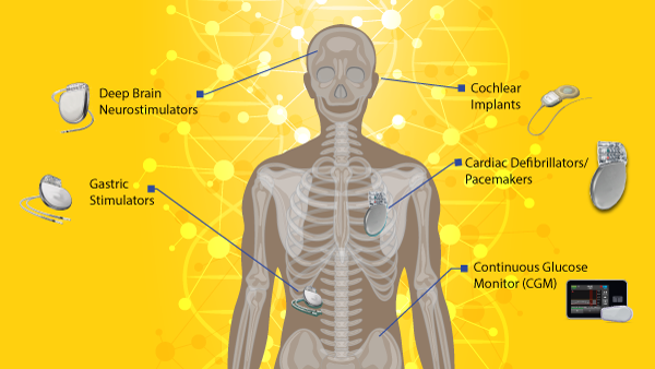 Illustration for SeqMatic Blog Forums about Human Anatomy and Medical Devices